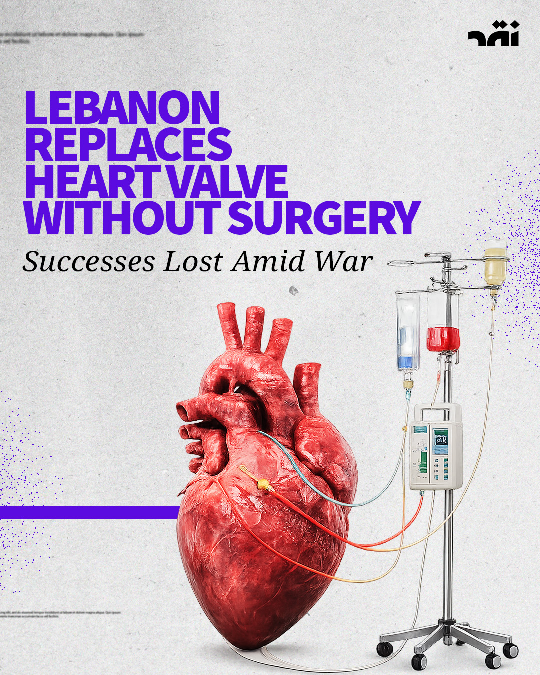 LEBANON REPLACES HEART VALVE WITHOUT SURGERY